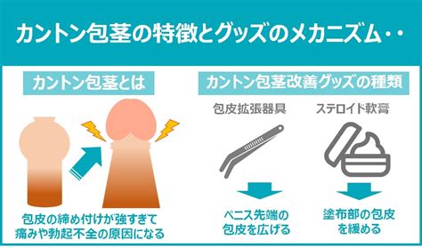 かんとんほう|【図解】真性包茎・仮性包茎・カントン包茎。各種類の特徴と違。